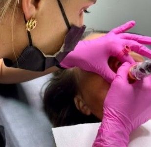 Micropigmentação labial sendo realizada